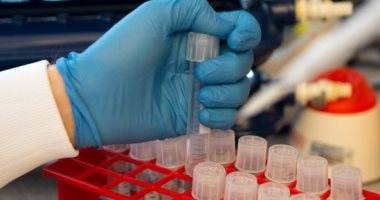 مواعيد عمل مراكز لقاحات كورونا خلال إجازة عيد الفطر؟ .. اعرف التفاصيل|