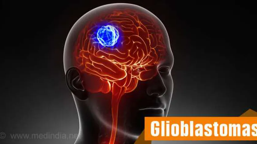 سرطان المخ - تعبيرية