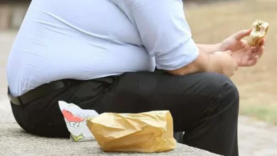 أمراض السمنة - صورة أرشيفية